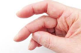 パソコン,リウマチ,SIRIUS手が痛い